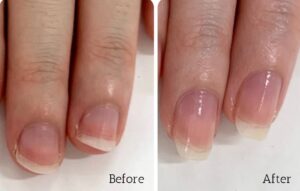 東京自由が丘ネイルサロン|最強のネイルケア専門店ROSE ROSE|深爪対応 - ROSE ROSE|自由が丘ネイルケア専門店 東京自由が丘ネイルサロン|最強のネイルケア専門店ROSE ROSE|深爪対応